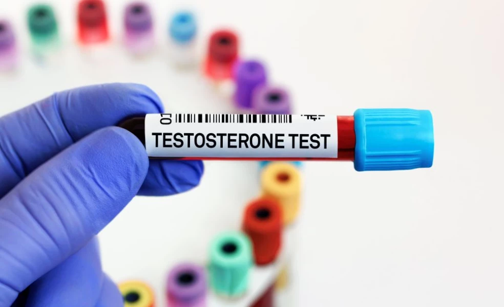 testosteron u žen