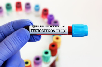 Testosteron v těle ženy: Tyto signály jeho nadbytku neignoruj!