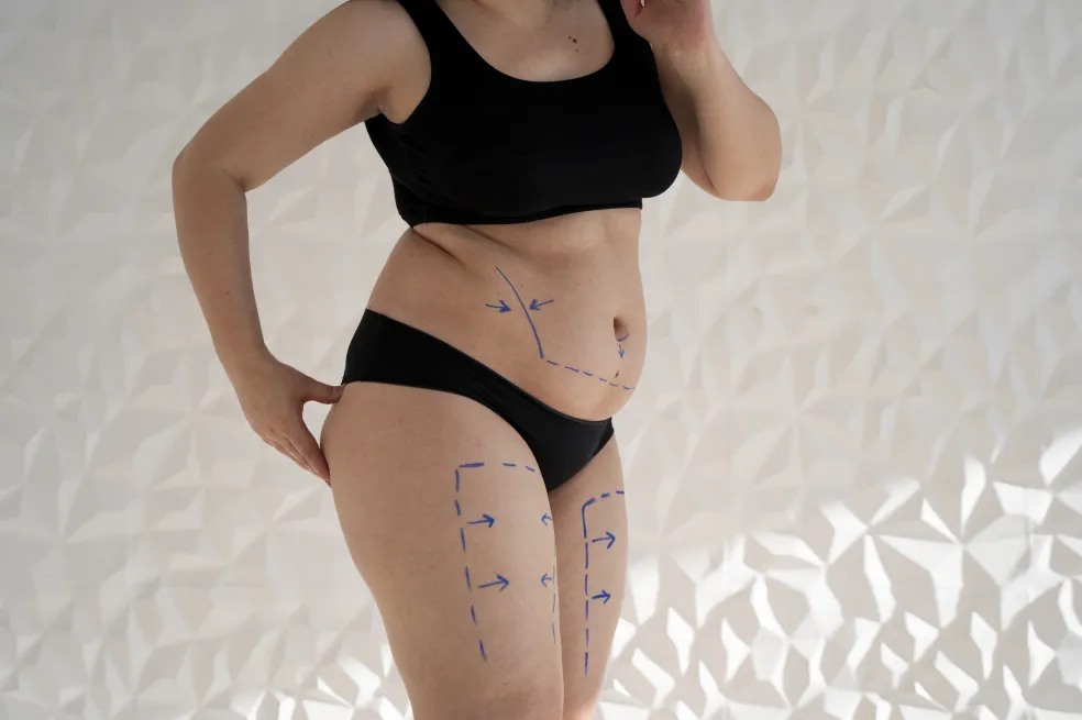 body contouring