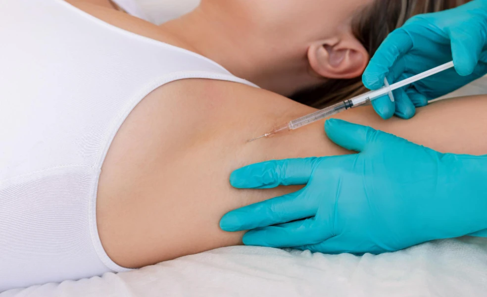 botox proti pocení
