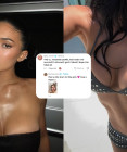 Kylie Jenner na žiadosť fanúšičky odhalila všetko o svojich implantátoch: Postupy aj meno chirurga!