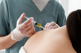Trapézový botox: Nový hit na TikToku, nebo skutečná medicínská pomoc?