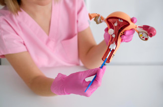 Cytologie děložního čípku: Proč by ji ženy neměly odkládat?