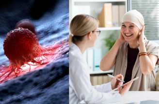 Co jsou prekancerózy? Jejich léčba může zvrátit rozvoj rakoviny!