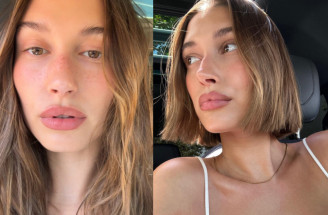 Hailey Bieber a její nový trik s korektorem: Rozjasněná pleť už za pár sekund