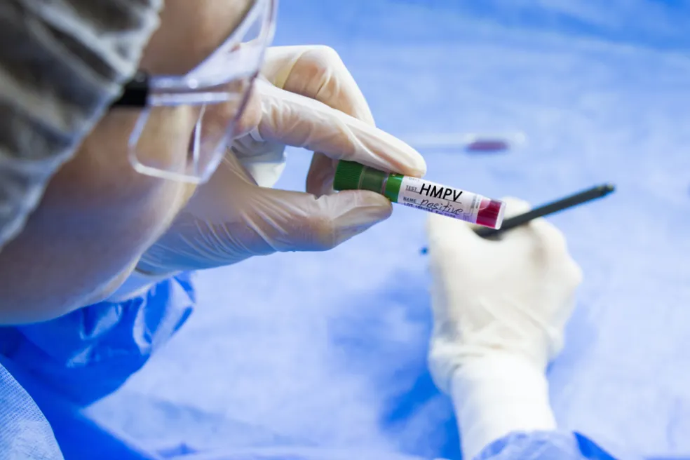 Diagnostika hMPV infekce