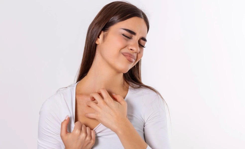 jak zlepšit stav ekzému