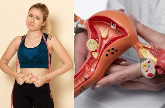 Hubnutí při PCOS může být náročné. Proč se vás kila drží a co s tím udělat?