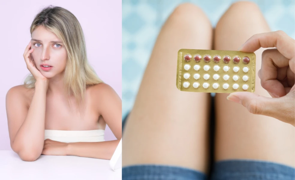 vliv hormonální antikoncepce na pleť