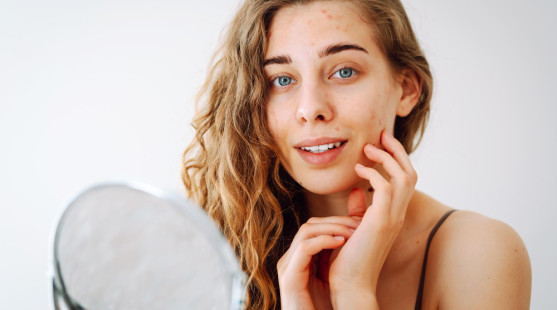 Kortizol a pleť: Jak stres ničí jas a kontury obličeje