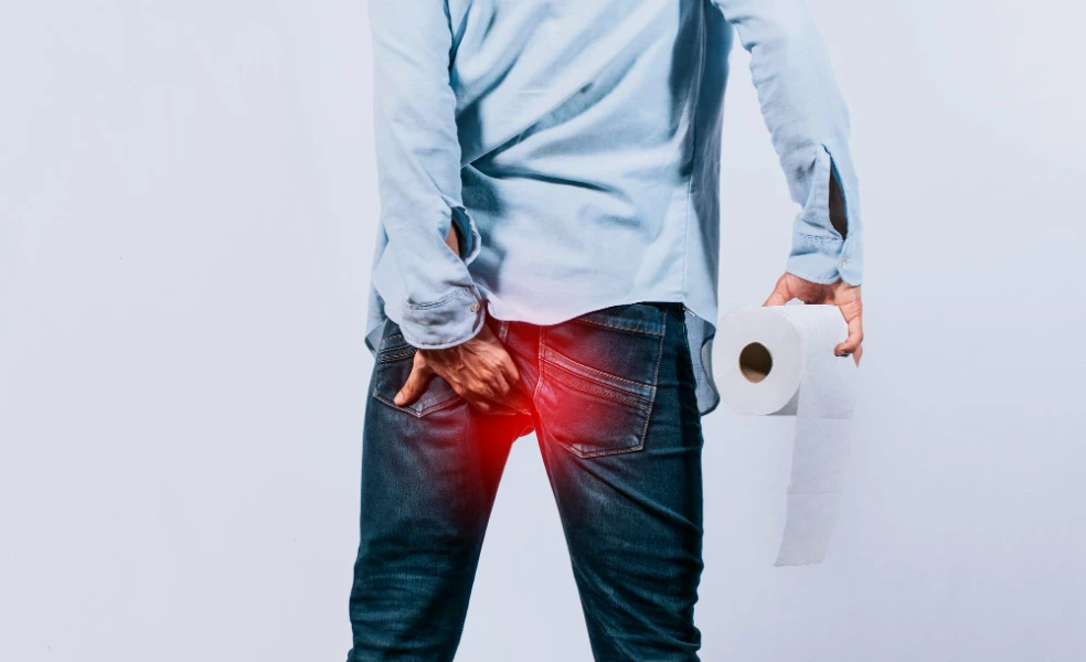 příčiny hemoroidů