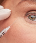 Polynukleotidy pod oči: Čo dokážu s kruhmi a vráskami a kedy sú lepšie než výplň?
